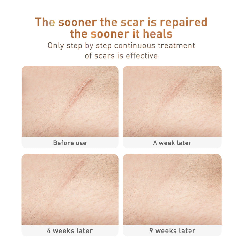 Herbal Repair Gel for Scar Removal